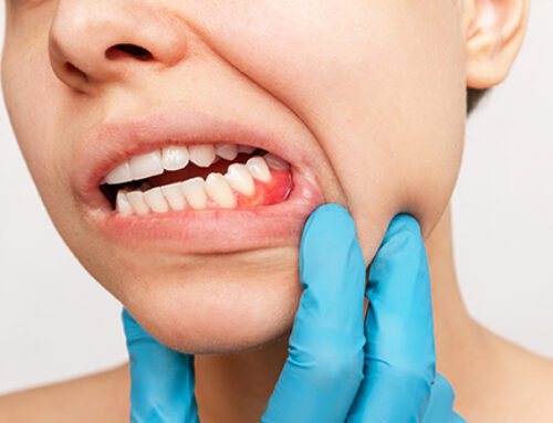 A new way to prevent gum disease without wiping out good bacteria